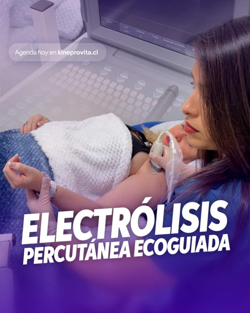 electrolisis percutanea ecoguiada en Reñaca KineProVita