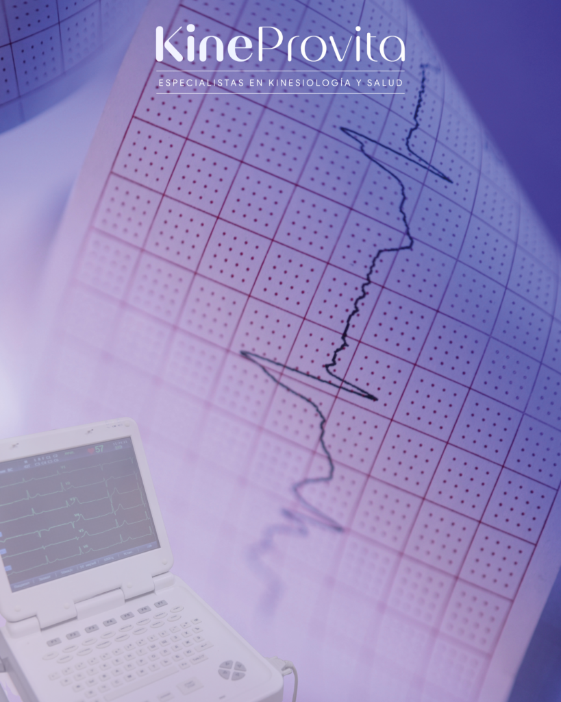 electrocardiograma adulto en Reñaca KineProVita