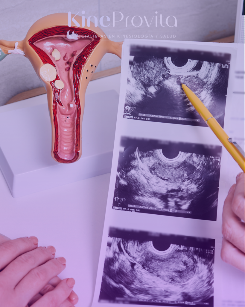 consulta de matrona en Reñaca KineProVita